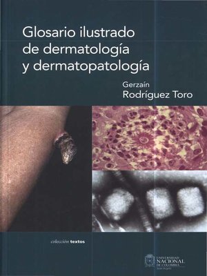 cover image of Glosario ilustrado de dermatología y dermatopatología